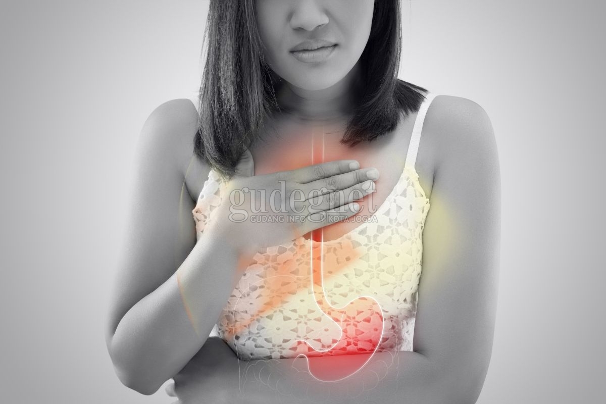 Cara Cepat Meredakan Asam Lambung Cara Cepat Meredakan Asam Lambung